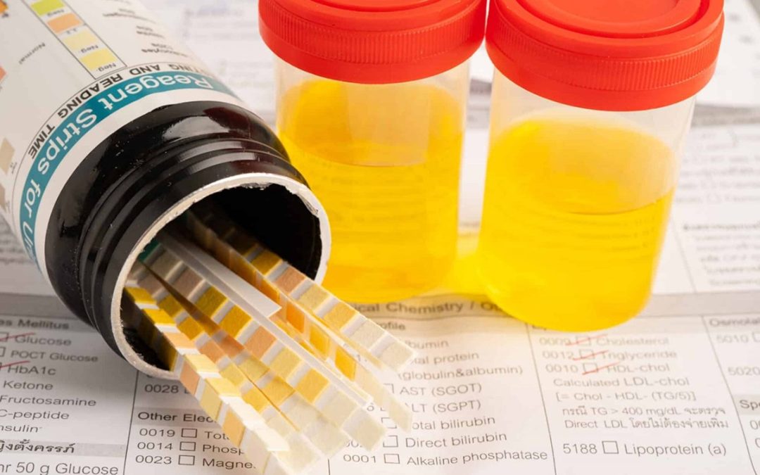 Suboxone: How Long Does It Stay In Your System?